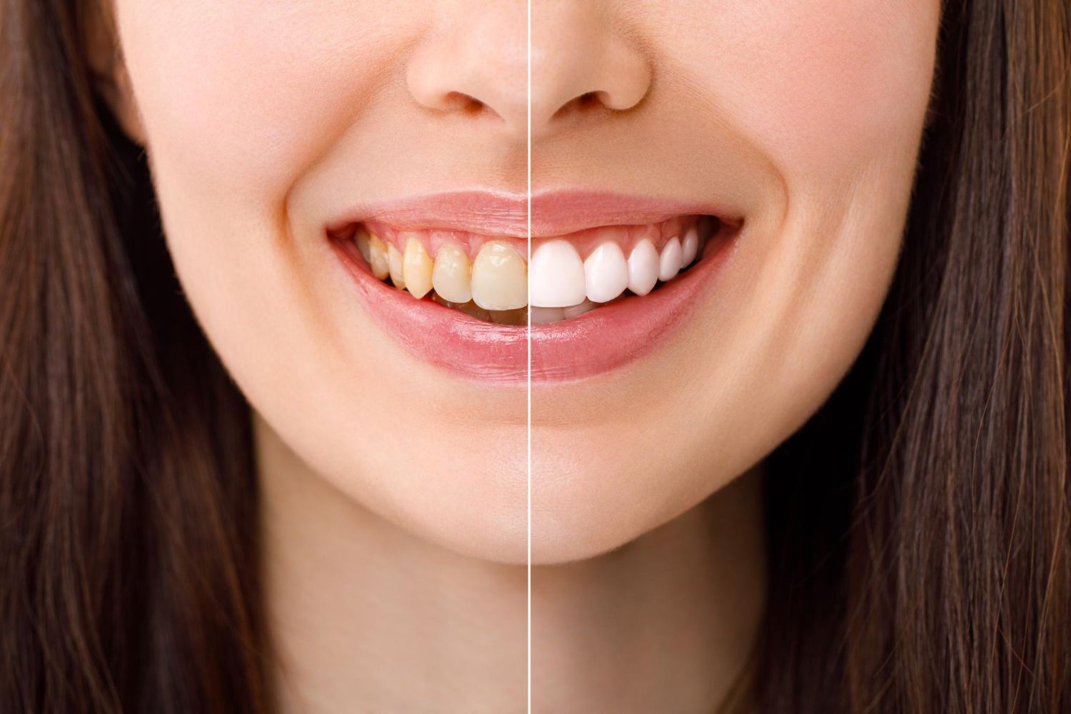 Cosmetic Dentistry